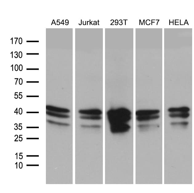 UPRT Antibody (clone OTI1D11, Carrier-free)