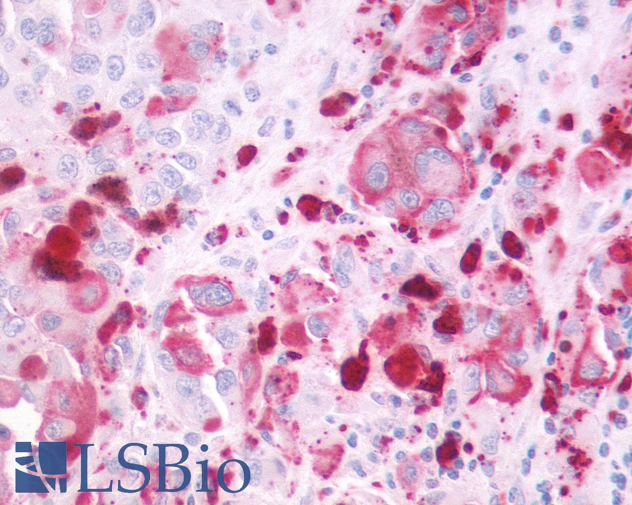 IHC-plus™ P2RY4 / P2Y4 Antibody (Extracellular Domain)