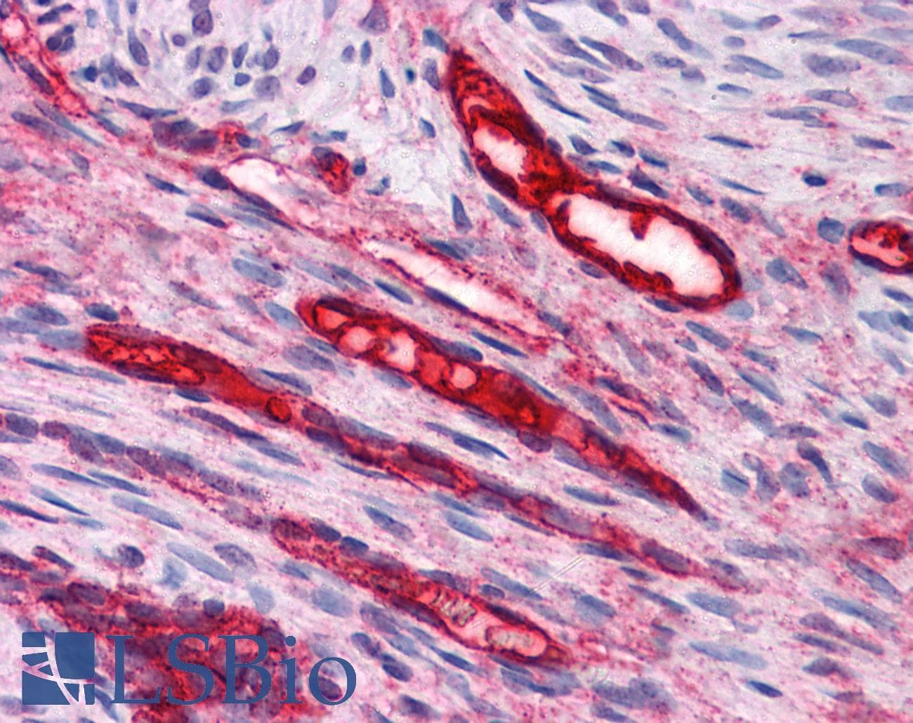 IHC-plus™ BUB3 Antibody