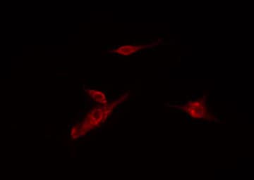Polyclonal Rabbit anti-Human HK3 / Hexokinase 3 Antibody (IF, WB)