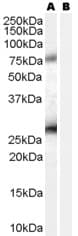 IHC-plus™ EBAG9 / RCAS1 Antibody (aa240-251)