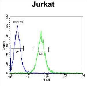BCKDHA / BCKDE1A Antibody (aa362-390)