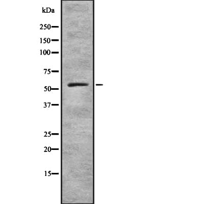 ZNF497 Antibody