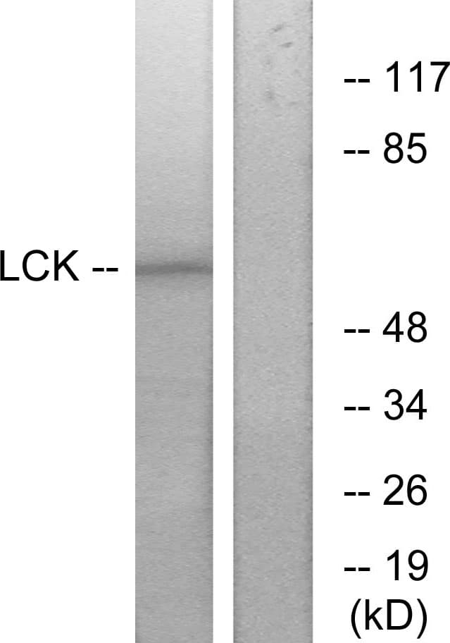 p56lck / LCK Antibody (aa361-410)