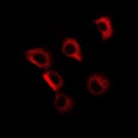 Polyclonal Rabbit anti-Human GOLM1 / GP73 / GOLPH2 Antibody (IHC, IF, WB)