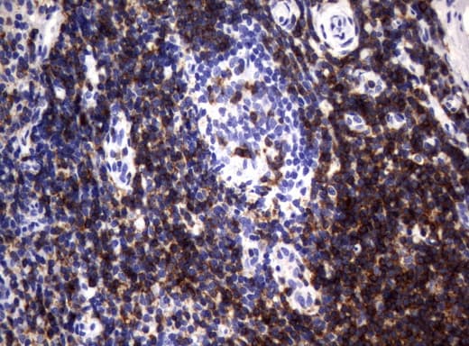 CD2 Antibody (clone UMAB86)