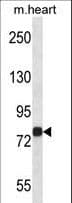Polyclonal Rabbit anti-Human GCK / Germinal Center Kinase Antibody (aa432-459, WB)