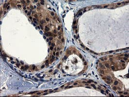 CNOT4 / CLONE243 Antibody (clone OTI1H2)