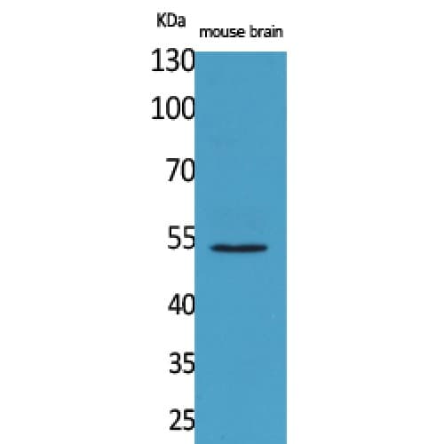 CPE / Carboxypeptidase E Antibody (421-470 aa, C-terminal)