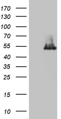 IP6K2 Antibody (aa1-250, clone OTI1F12, Carrier-free)