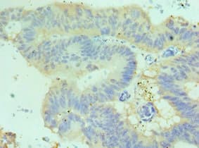 Polyclonal Rabbit anti-Human CDH17 / Cadherin 17 Antibody (aa573-832, IHC)