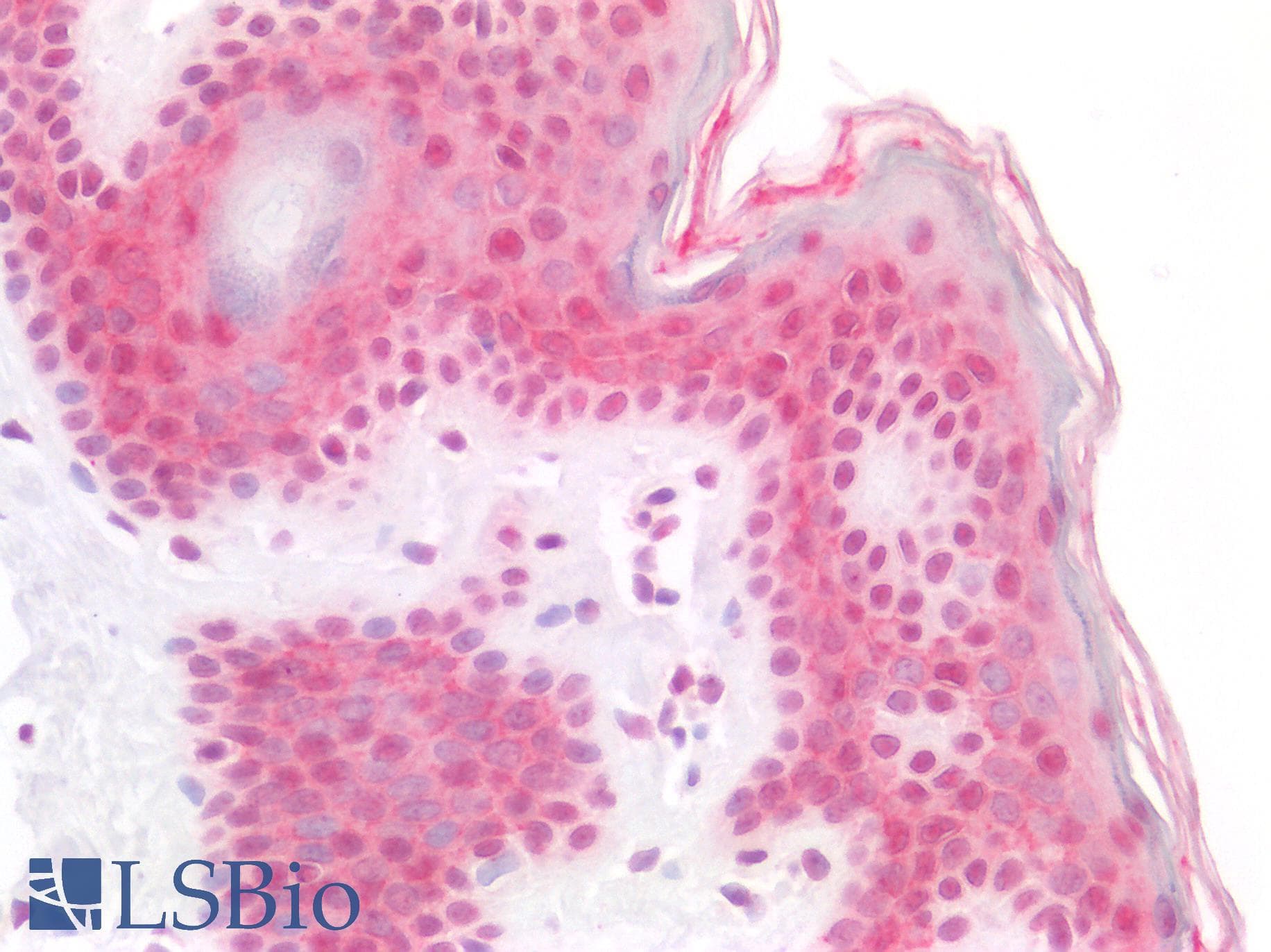 PathPlus™ SMARCB1 / INI1 Antibody