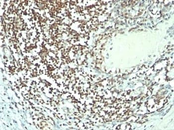NCL / Nucleolin Antibody (aa364-365, clone 364-5 + NCL/902, Ready-to-Use)