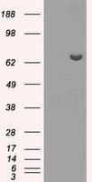 Monoclonal Mouse anti-Human HDAC10 Antibody (clone OTI5E2, IHC, WB)