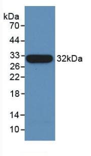 TUBB / Beta Tubulin Antibody (FITC)