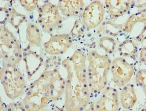Polyclonal Rabbit anti-Human COLEC11 Antibody (aa26-271, IHC, WB)