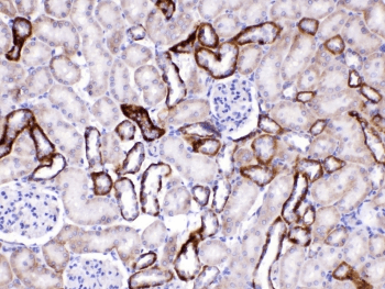 GAD65 Antibody