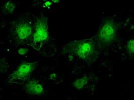 PathPlus™ NF45 / ILF2 Antibody (clone OTI6F1)