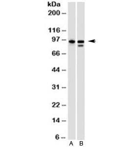 HSP90B1 / GP96 / GRP94 Antibody (clone SPM249)