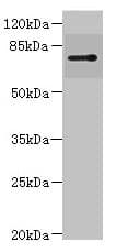 RHOBTB1 Antibody