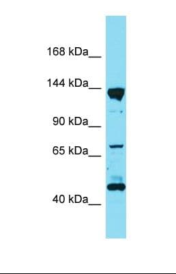 Polyclonal Rabbit anti-Rat PPFIA3 Antibody (aa1074-1123, WB)