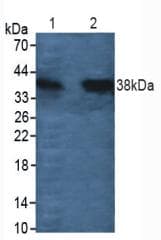 CTSL / Cathepsin L Antibody (aa114-288, APC)