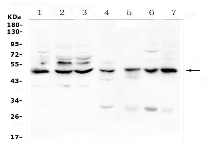 TNFRSF1A / TNFR1 Antibody