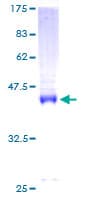 Human CNBP / ZNF9 Protein (Recombinant GST)