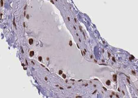 SMAD1 Antibody (phospho-Ser465)