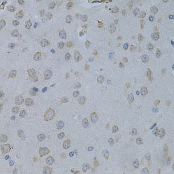 STMN1 / Stathmin / LAG Antibody