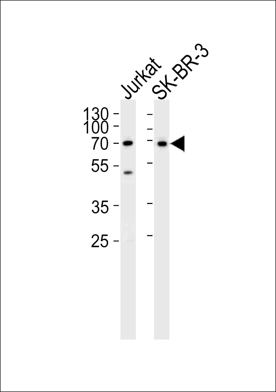 CD46 Antibody (aa317-343)