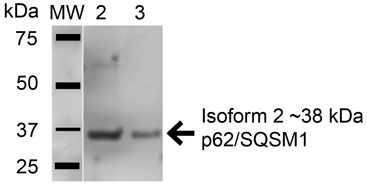 SQSTM1 Antibody (Biotin)