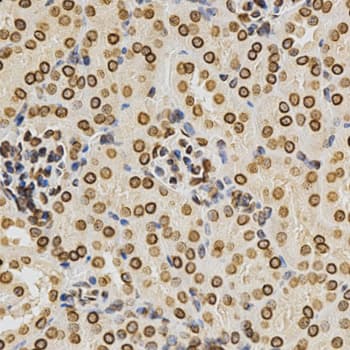 LMNA / Lamin A+C Antibody