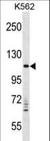 Polyclonal Rabbit anti-Human VPS11 Antibody (aa772-800, WB)