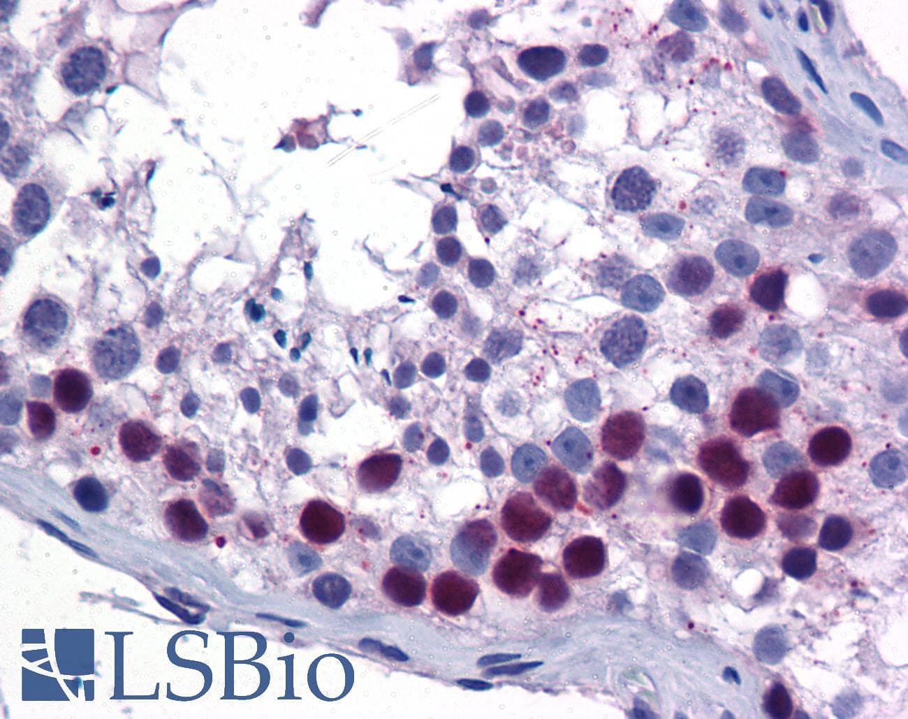 SIRT6 / Sirtuin 6 Antibody (aa56-105)
