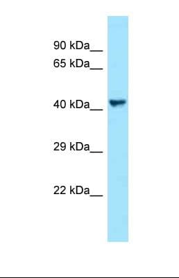 Polyclonal Rabbit anti-Human VEGFC Antibody (aa286-335, WB)