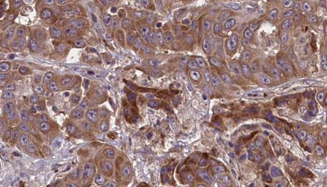 ANPEP / CD13 Antibody