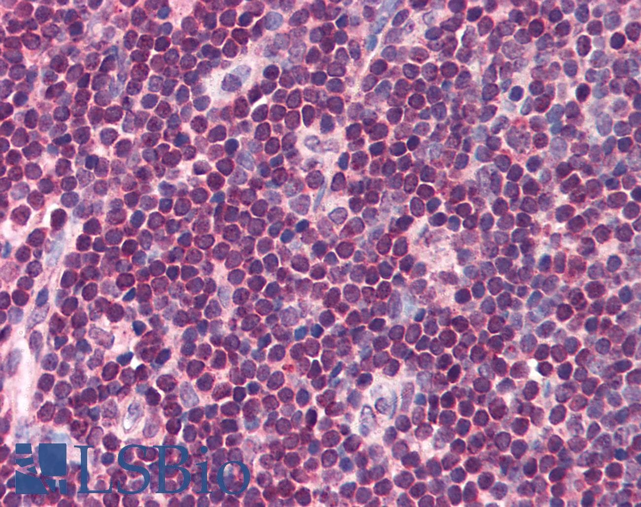 IHC-plus™ ICSBP / IRF8 Antibody