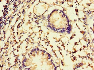 Polyclonal Rabbit anti-Human FBXW5 Antibody (IHC, IF, WB)