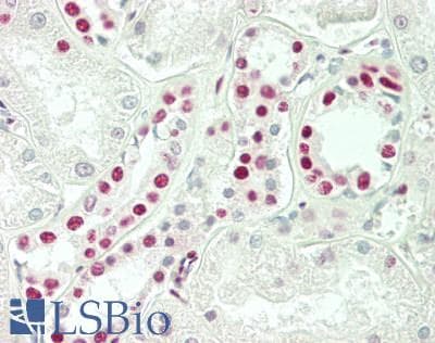 IHC-plus™ SNRPD3 Antibody (aa99-126)