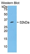SERPINA7 / TBG Antibody (aa127-393)