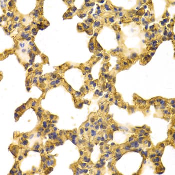 Polyclonal Rabbit anti-Human ANXA6/Annexin A6/Annexin VI Antibody (IHC, IF, WB)