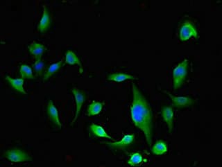 Polyclonal Rabbit anti-Human Esterase D / ESD Antibody