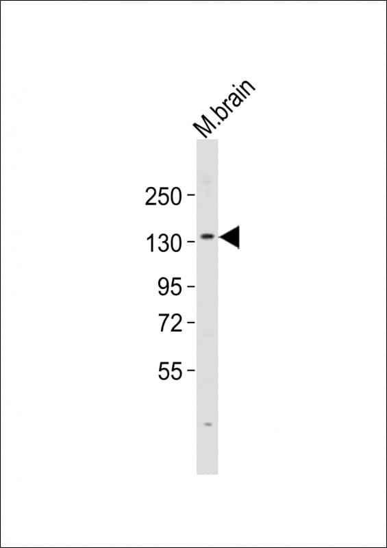 Polyclonal Rabbit anti-Mouse EHMT2 / G9A Antibody (aa589-623, WB)