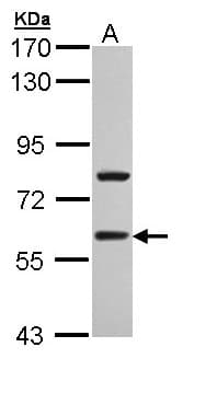 Polyclonal Rabbit anti-Human TBL1XR1 / TBLR1 Antibody (aa210-514, IHC, WB)