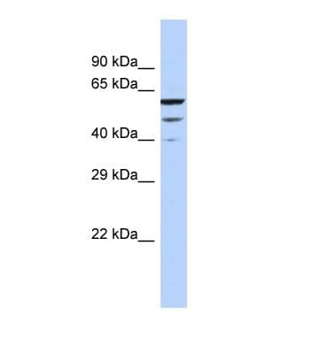 Polyclonal Rabbit anti-Human MCTP2 Antibody (aa223-272, WB)
