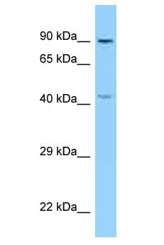 KIF3B Antibody (aa391-440)