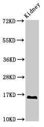 Polyclonal Rabbit anti-Human SYNJ2BP / OMP25 Antibody (IHC, WB)
