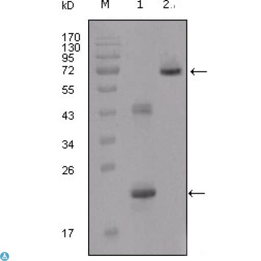 IGFBP2 / IGF-BP53 Antibody