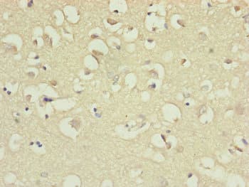 Polyclonal Rabbit anti-Human IL36A Antibody (IHC)